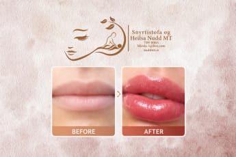 Fyllri og fallegri varir - Permanent Lip Blush