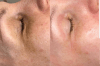 Flax-sculpt 5 skipti með 40% afslætti hjá Beauty Studio