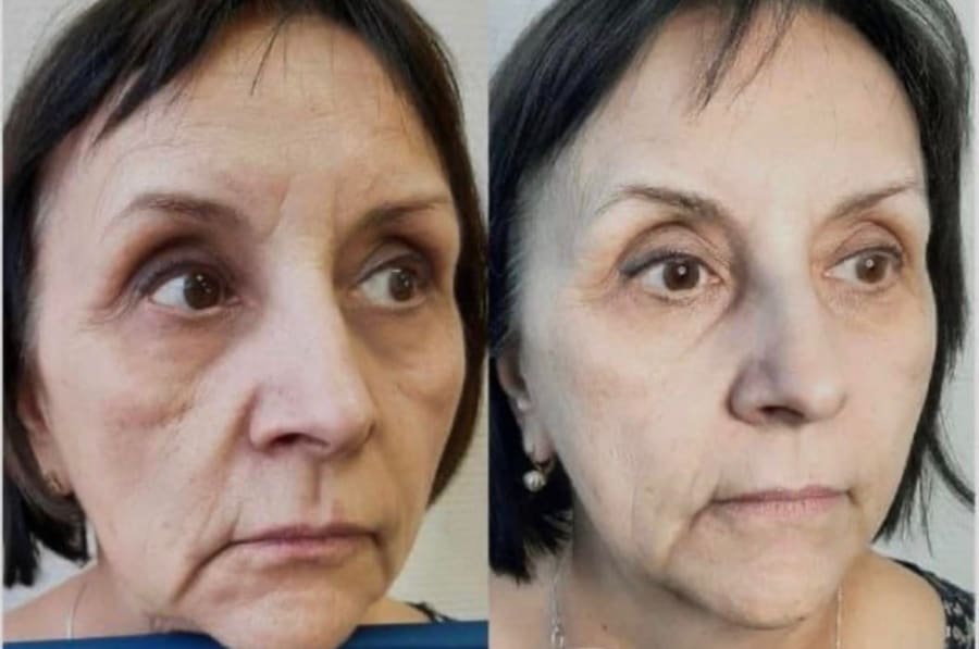 Flax-sculpt 5 skipti með 40% afslætti hjá Beauty Studio