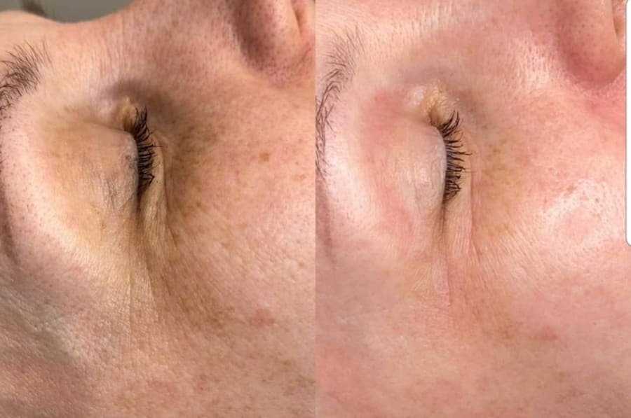 Flax-sculpt 5 skipti með 40% afslætti hjá Beauty Studio